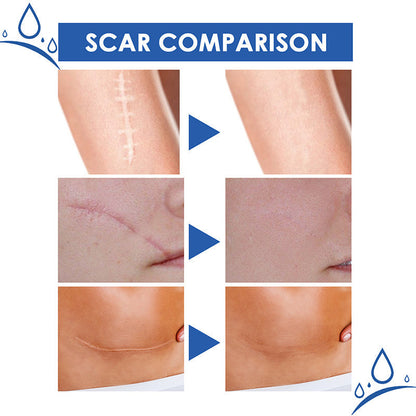 𝑶𝒇𝒇𝒊𝒄𝒊𝒂𝒍 𝑺𝒕𝒐𝒓𝒆 | LBMLBM® Science-Backed Scar Removal Cream: Restore Your Skin’s Natural Texture in as little as 4 Weeks